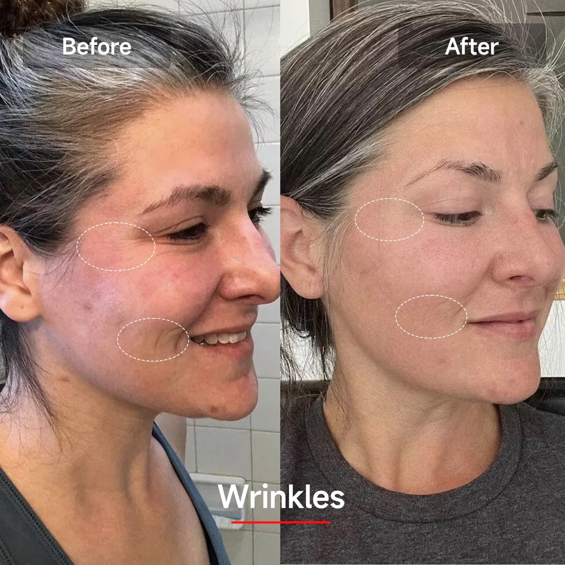 Lumeira 7 Color Photon Therapy Mask