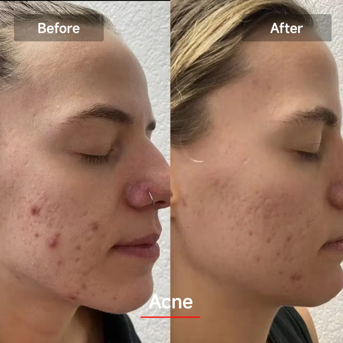 Lumeira 7 Color Photon Therapy Mask