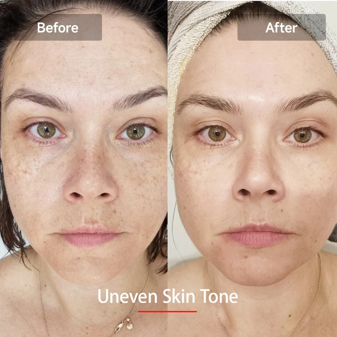 Lumeira 7 Color Photon Therapy Mask